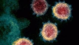 صورة مجهرية لفيروس كورونا المستجد