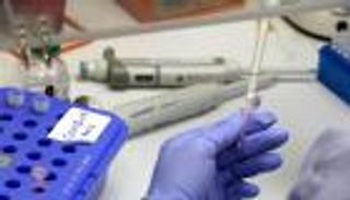 "الحاضنون الصامتون".. وراء انتشار كورونا السريع في العالم