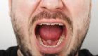 أحداث الماضي تكشف آثارها على الأسنان حتى بعد الوفاة