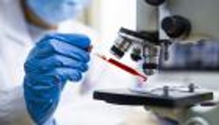 الكلوروكين.. أمل علاج كورونا يواجه الانقسام