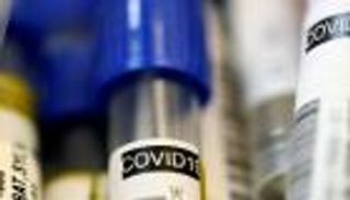 موريتانيا تعلن شفاء حالتي إصابة بكورونا