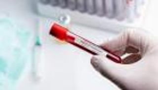 9 إصابات جديدة بفيروس كورونا في فلسطين