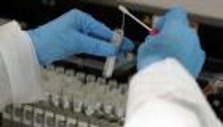 أول وفاة بفيروس كورونا في إثيوبيا