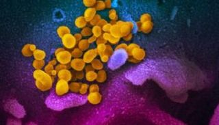 فيروس كورونا باللون الأصفر معزول من أحد المرضى