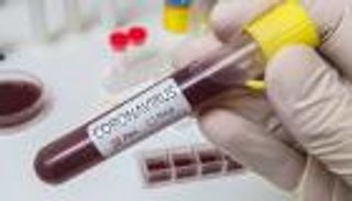 دراسة: كورونا يضر بالجهاز العصبي