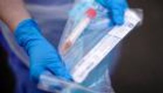  ارتفاع إصابات كورونا في لبنان إلى 630