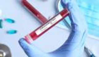 7 وفيات و429 إصابة جديدة بفيروس كورونا في السعودية