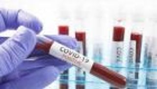 22 إصابة جديدة بكورونا في تونس.. وأغلب المصابين بالعاصمة 