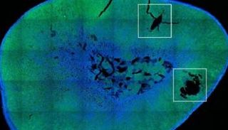 جسيمات نانوية مغناطيسية تحفز الغدة لإنتاج هرمونات