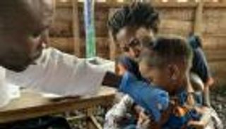 الحصبة تهدد 117 مليون طفل وسط تداعيات كورونا