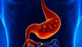 طرق علاج حرقة المعدة وأسبابها