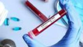 ارتفاع إصابات كورونا في قطر  إلى 4663