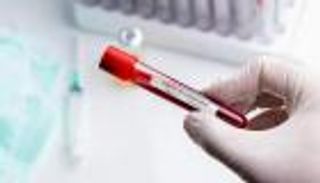 9 إصابات جديدة بفيروس كورونا في إثيوبيا