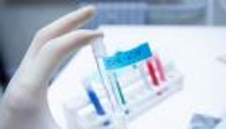 ارتفاع حالات الشفاء من كورونا في الكويت إلى 305