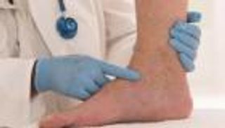 الجلوس طويلا يهددك بجلطة الساق.. 5 طرق للوقاية 