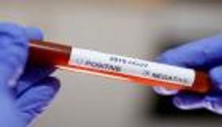 تراجع إصابات كورونا الجديدة في لبنان