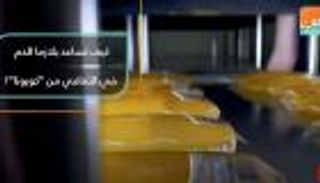 كيف تساعد بلازما الدم في التعافي من "كورونا"؟