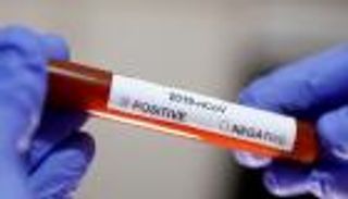 1122 إصابة جديدة بكورونا في السعودية.. وتعافي 1490