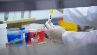 حثت المفوضية الأوروبية دول الاتحاد على "حماية نفسها" من هذا التهديد