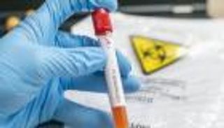 4 وفيات و278 إصابة جديدة بفيروس كورونا في الكويت