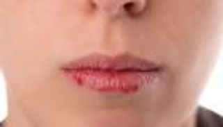 5 طرق لحماية الشفاه من الجفاف خلال شهر رمضان