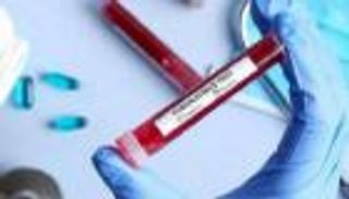 إصابتان جديدتان بكورونا في إثيوبيا