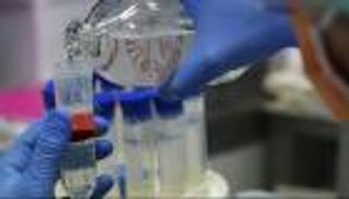 فرنسا تختبر علاجا للسرطان على مرضى كورونا