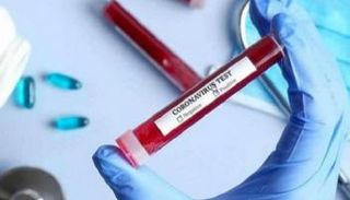 نتيجة تحليل فيروس كورونا المستجد