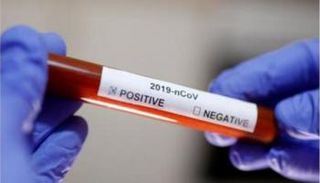 شركات أدوية عالمية تتسابق على وقف زحف كورونا