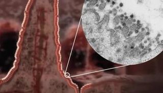  رسم لخلية بالأمعاء مع تكبير صورة مجهرية لفيروس كورونا