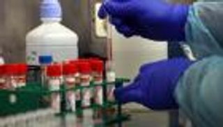 229 وفاة و16 ألف إصابة بفيروس كورونا في إسرائيل