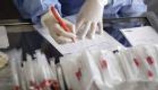 إصابات كورونا في لبنان ترتفع إلى 737 