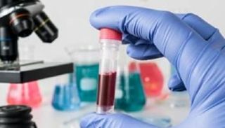 شركة "روش" تحصل على موافقة أمريكية لاختبار الأجسام المضادة لكورونا