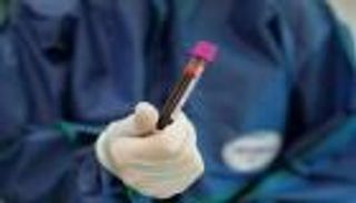 الصين تسجل حالة إصابة وافدة ولا وفيات