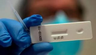 فحص الأجسام المضادة يخبرك عما إن كنت قد التقطت الفيروس - الجارديان