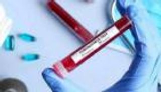 إثيوبيا تسجل 3 إصابات جديدة بفيروس كورونا 