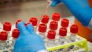 ارتفاع إصابات كورونا في لبنان لـ796.. والوفيات 26