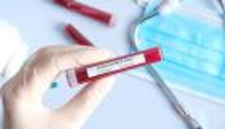 151 إصابة جديدة بفيروس كورونا في البحرين