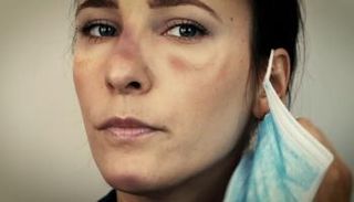 نصائح بسيطة لتجنب تهيج البشرة في زمن كورونا