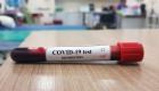 المغرب يسجل 38 إصابة جديدة بفيروس كورونا