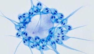 طفيل سمك السلمون المعروف باسم هينيجويا سالمينيكول