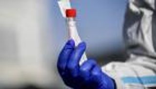 السعودية تسجل 9 وفيات و2509 إصابات جديدة بكورونا