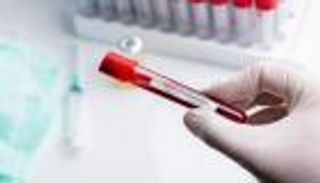 5 إصابات جديدة بكورونا في فلسطين