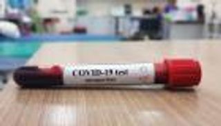 إثيوبيا تسجل 24 إصابة جديدة بكورونا