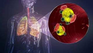 كيف يقلب كورونا المناعة ضدنا - أرشيفية