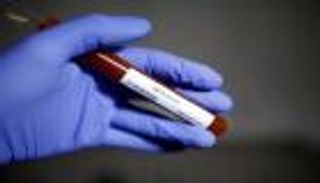 3 إصابات جديدة بفيروس كورونا في قطاع غزة