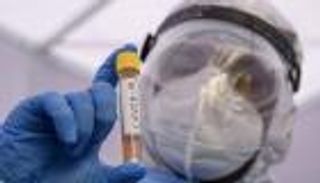 اختبار مزيج أكتيمرا وريمديسيفير لعلاج أعراض كورونا