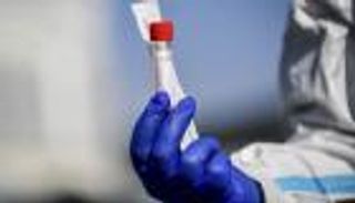 شفاء 517 وتسجيل 33 إصابة بكورونا في المغرب