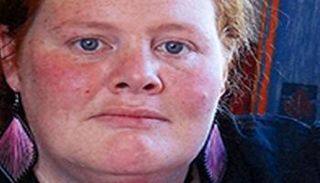 إمي لويز ثورب التي توفيت بسبب إدمانها المشروبات الغازية