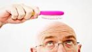 وداعا للصلع نهائيا.. الخلايا الجذعية أمل جديد للعلاج